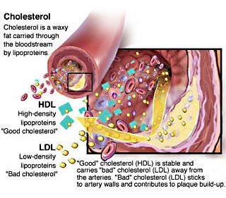 heart disease cholesterol ayurveda