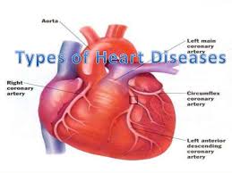 heart disease ayurveda